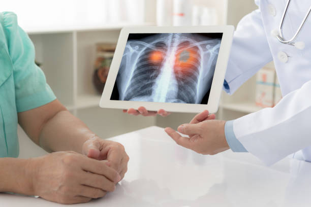 Lung cancer diagnosis and radiation therapy treatment by oncologist in Pune